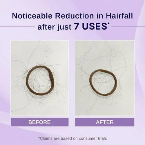 Bare Anatomy Rosemary & Hibiscus Hair Growth Oil (100 ml)