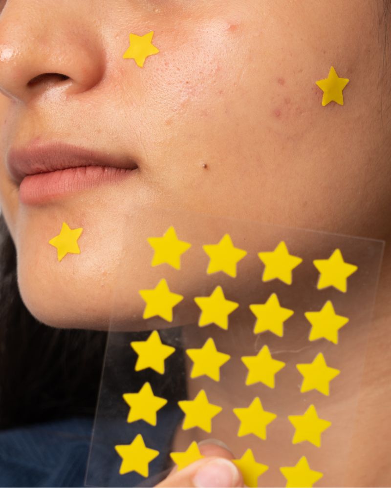 Gush Beauty Dart It - Pimple Patches ( Yellow Star )